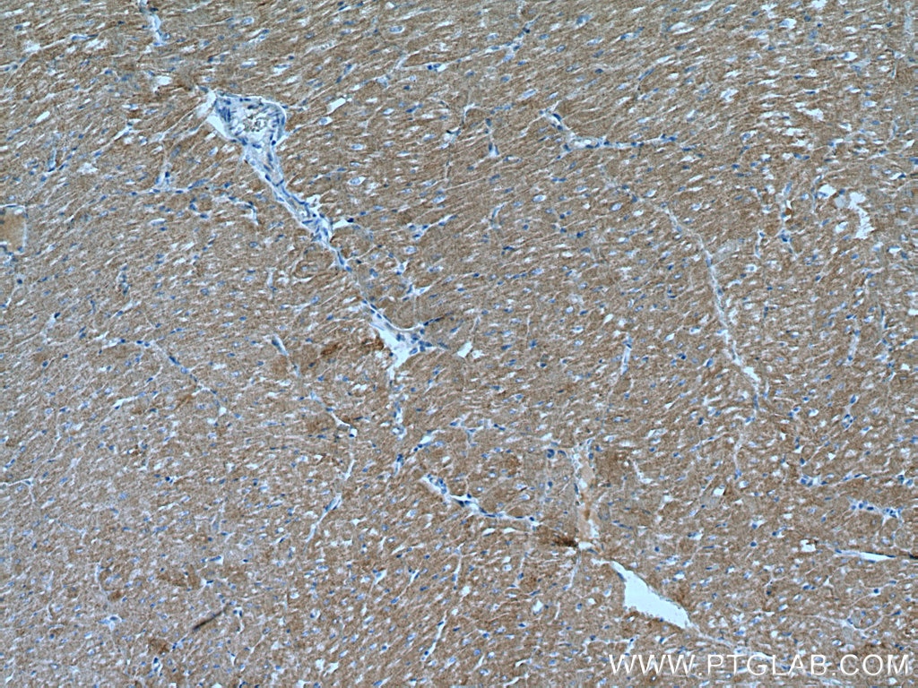 Immunohistochemistry (IHC) staining of human heart tissue using Myozenin 2 Polyclonal antibody (11450-1-AP)