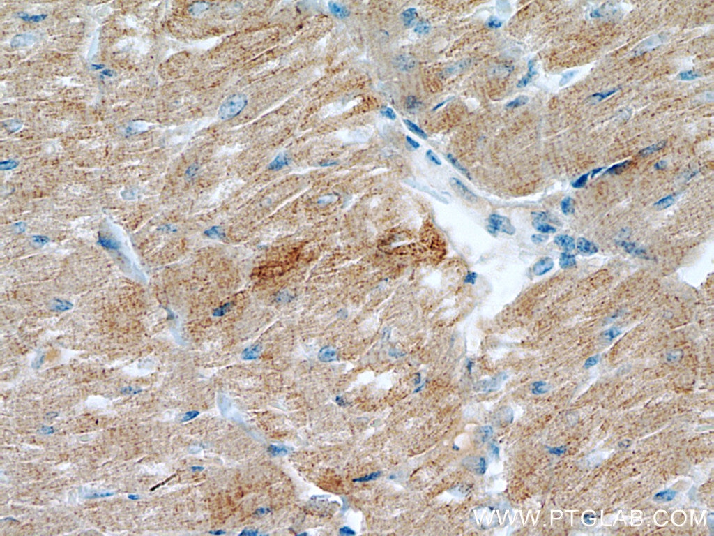 Immunohistochemistry (IHC) staining of human heart tissue using Myozenin 2 Polyclonal antibody (11450-1-AP)