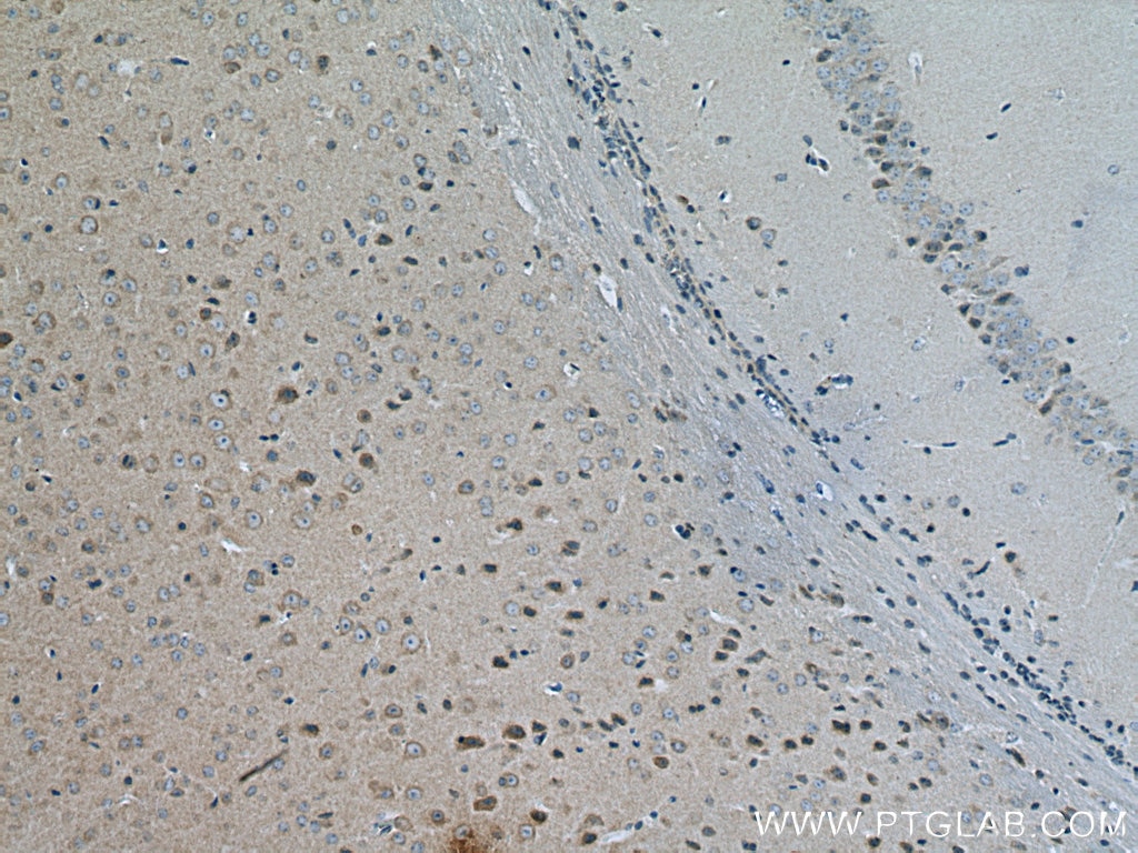 Immunohistochemistry (IHC) staining of mouse brain tissue using Myozenin 2 Polyclonal antibody (11450-1-AP)