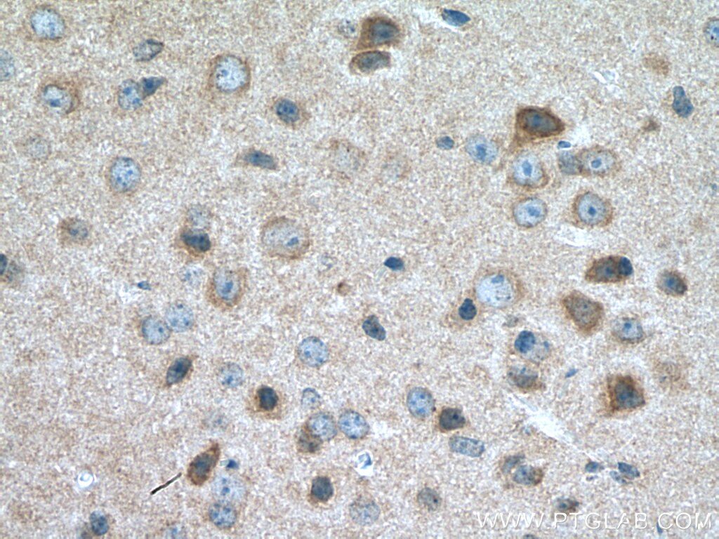Immunohistochemistry (IHC) staining of mouse brain tissue using Myozenin 2 Polyclonal antibody (11450-1-AP)