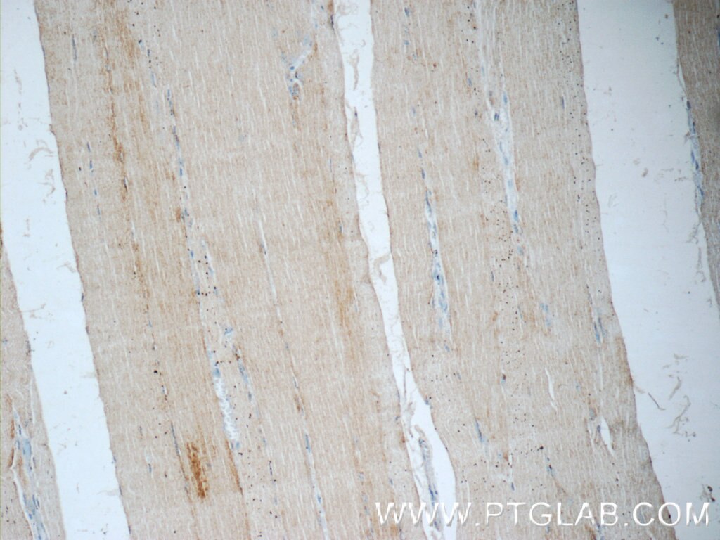 Immunohistochemistry (IHC) staining of human skeletal muscle tissue using MYOZ3 Polyclonal antibody (23880-1-AP)