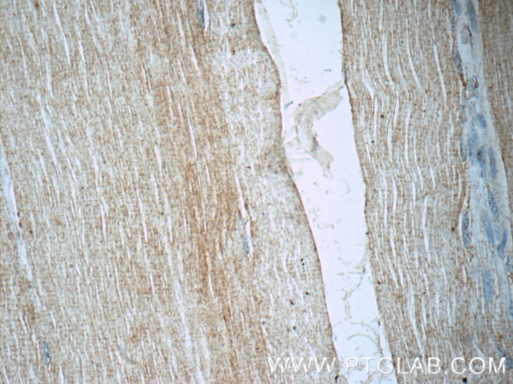 Immunohistochemistry (IHC) staining of human skeletal muscle tissue using MYOZ3 Polyclonal antibody (23880-1-AP)