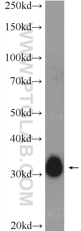 WB analysis of rat skeletal muscle using 23880-1-AP