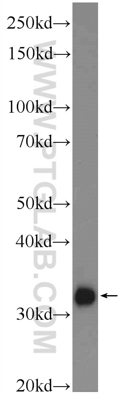 Western Blot (WB) analysis of rat skeletal muscle tissue using MYOZ3 Polyclonal antibody (23880-1-AP)