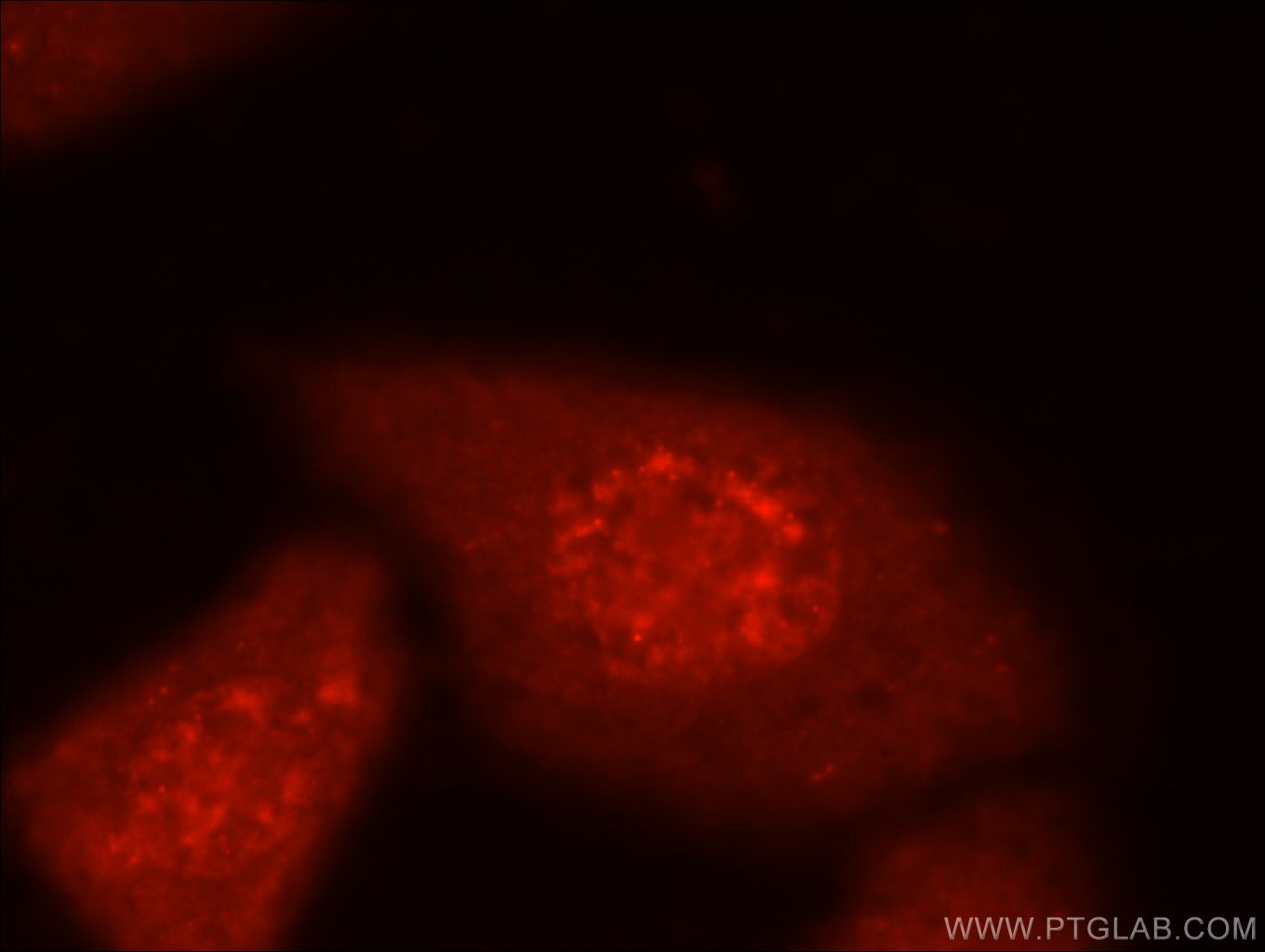 Immunofluorescence (IF) / fluorescent staining of HepG2 cells using MYPN-Specific Polyclonal antibody (16180-1-AP)