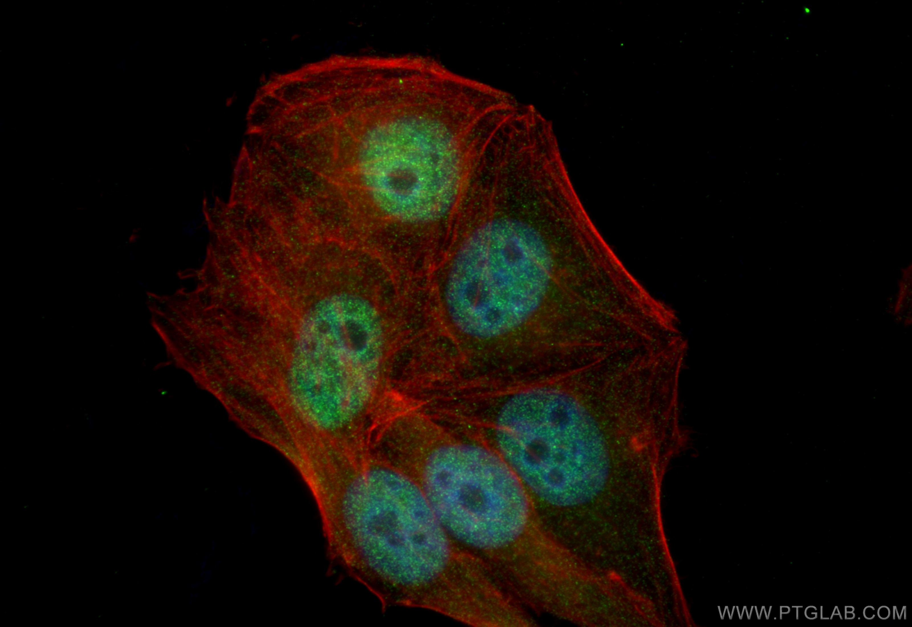 Immunofluorescence (IF) / fluorescent staining of HepG2 cells using MYPN-Specific Polyclonal antibody (16180-1-AP)