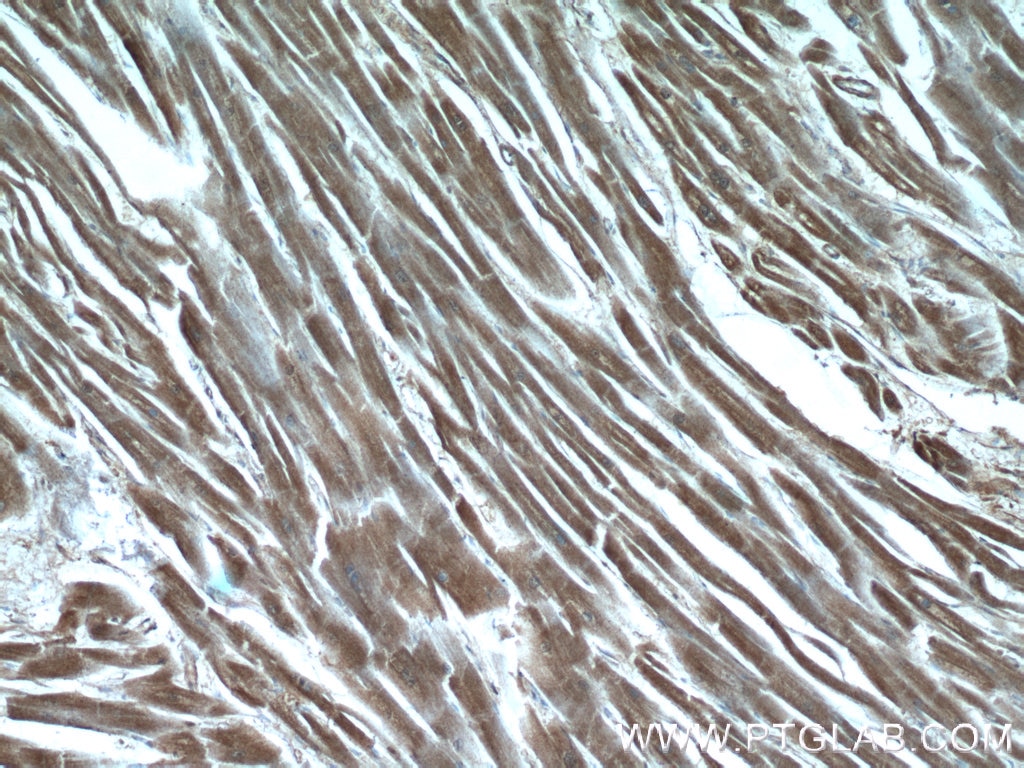 Immunohistochemistry (IHC) staining of human heart tissue using MYPN-Specific Polyclonal antibody (16180-1-AP)