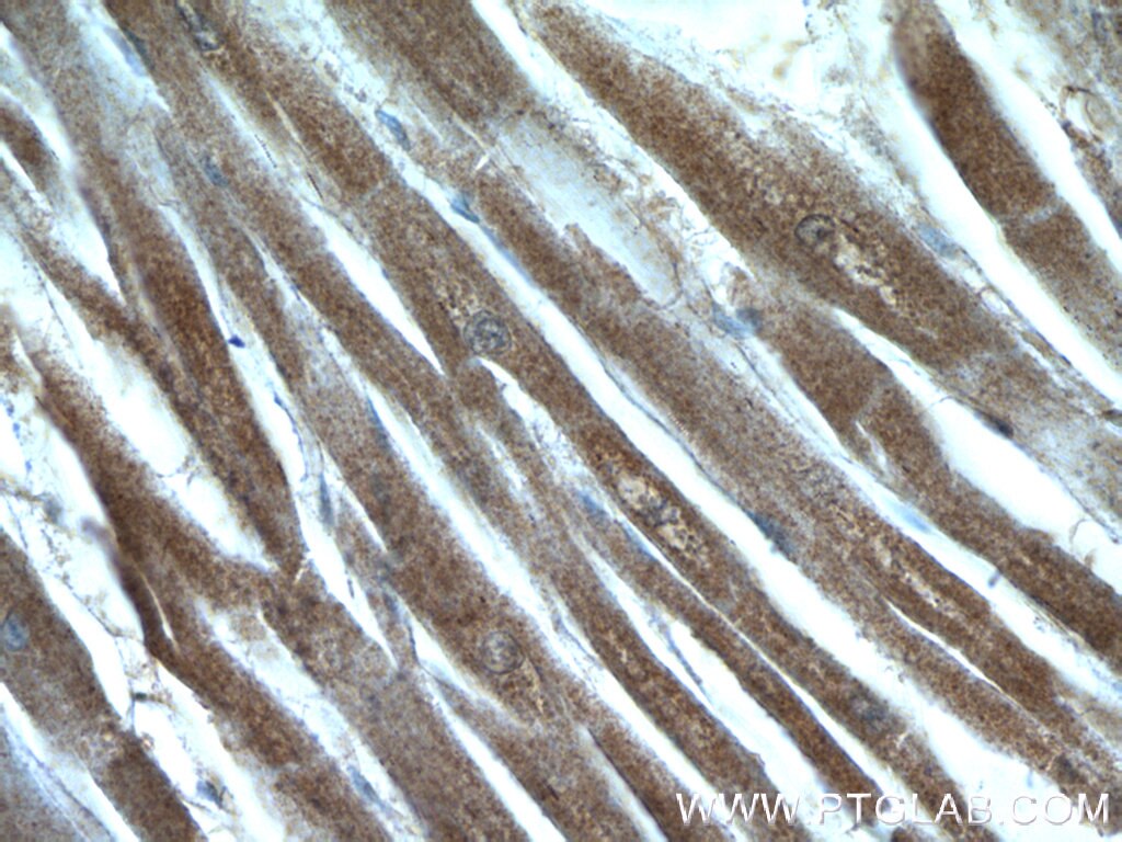 Immunohistochemistry (IHC) staining of human heart tissue using MYPN-Specific Polyclonal antibody (16180-1-AP)