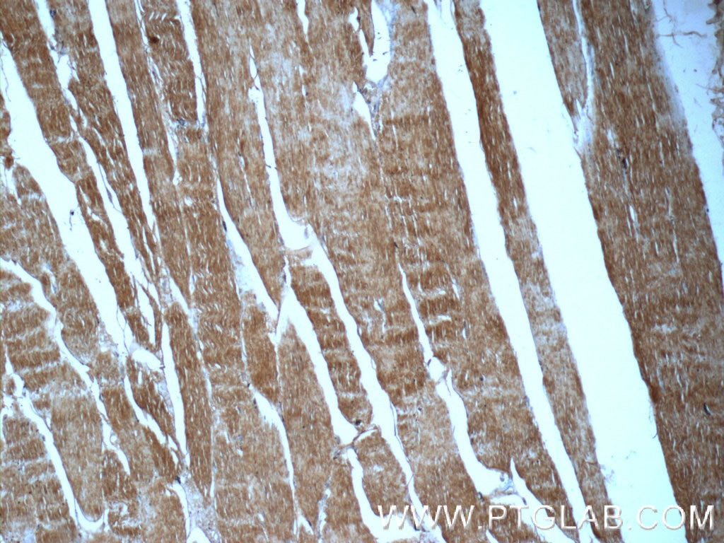 Immunohistochemistry (IHC) staining of human skeletal muscle tissue using MYPN-Specific Polyclonal antibody (16180-1-AP)
