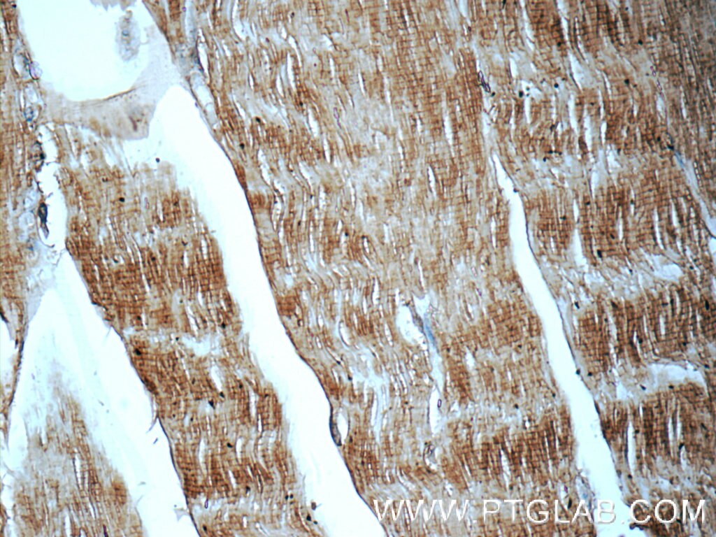 Immunohistochemistry (IHC) staining of human skeletal muscle tissue using MYPN-Specific Polyclonal antibody (16180-1-AP)