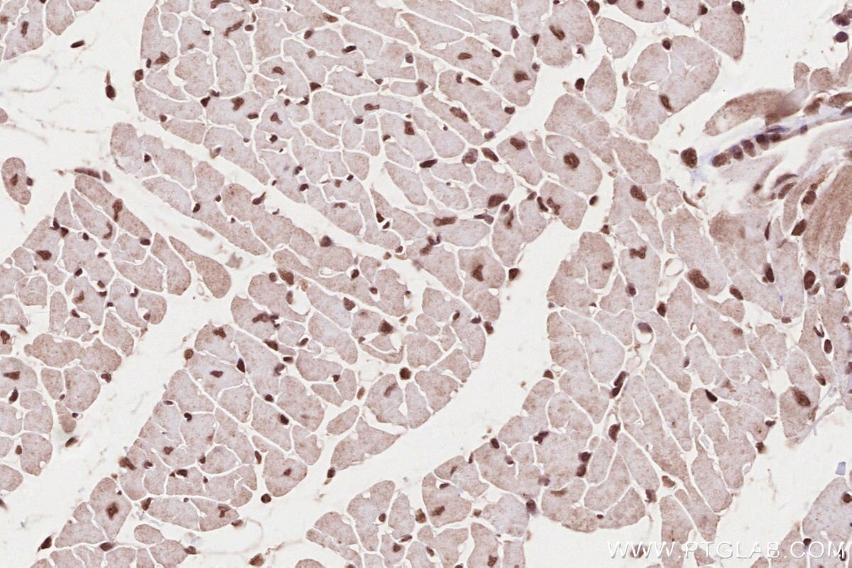 IHC staining of mouse heart using 16180-1-AP Immunohistochemistry (IHC) staining of mouse heart tissue using MYPN-Specific Polyclonal antibody (16180-1-AP)