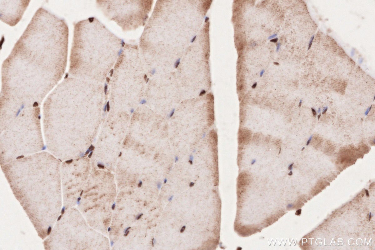 IHC staining of mouse skeletal muscle using 16180-1-AP Immunohistochemistry (IHC) staining of mouse skeletal muscle tissue using MYPN-Specific Polyclonal antibody (16180-1-AP)