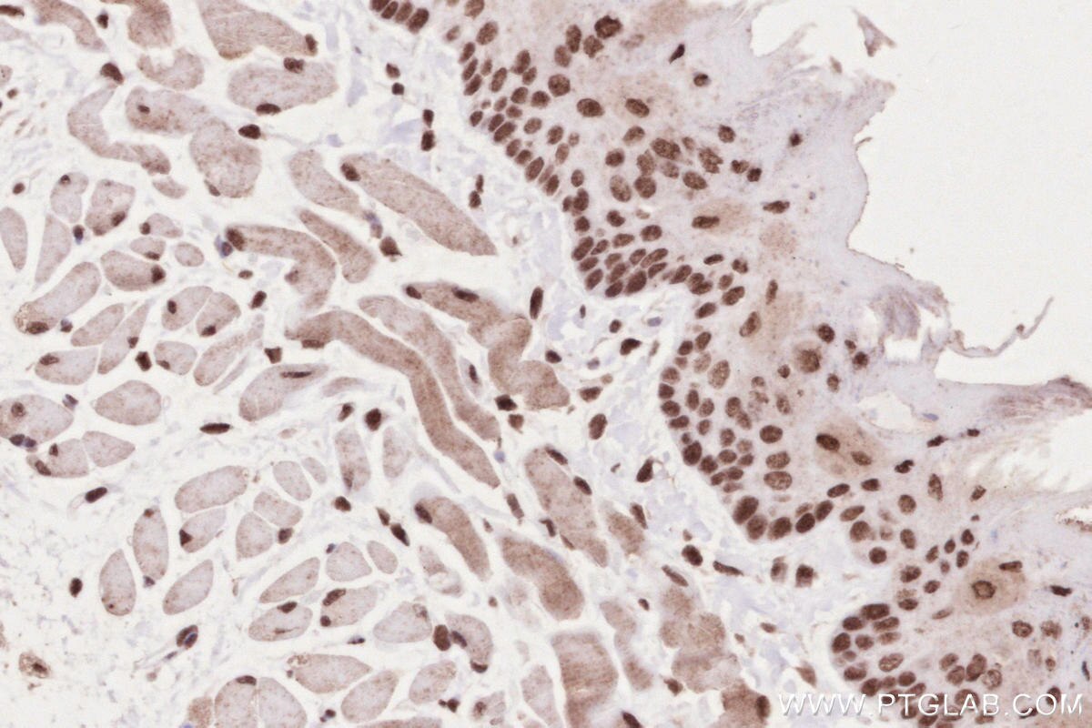 IHC staining of mouse tongue using 16180-1-AP Immunohistochemistry (IHC) staining of mouse tongue tissue using MYPN-Specific Polyclonal antibody (16180-1-AP)