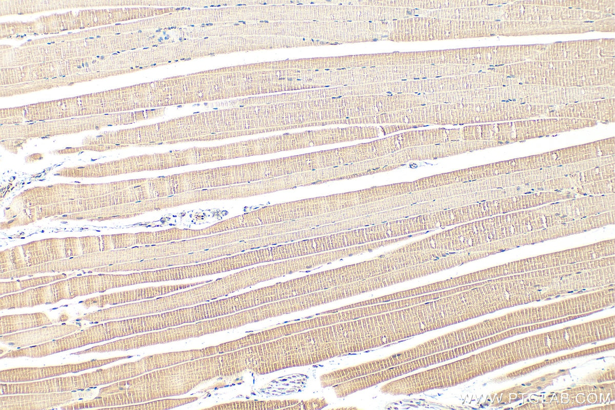 Immunohistochemistry (IHC) staining of mouse skeletal muscle tissue using MYPN-Specific Polyclonal antibody (16180-1-AP)