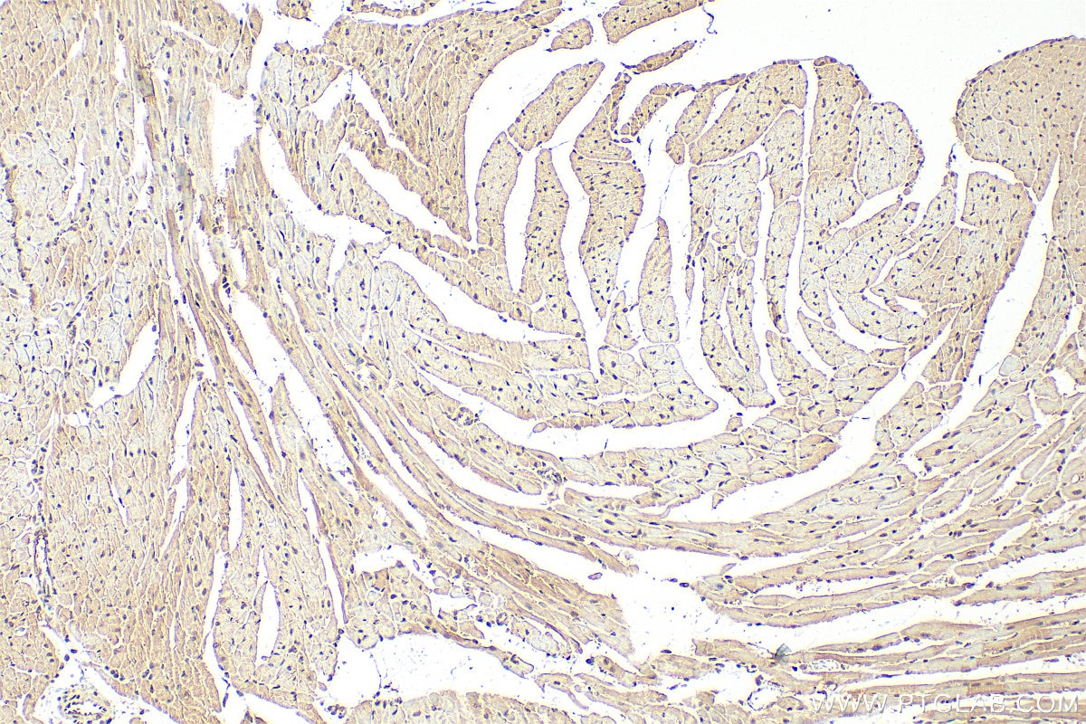 Immunohistochemistry (IHC) staining of mouse heart tissue using MYPN-Specific Polyclonal antibody (16180-1-AP)