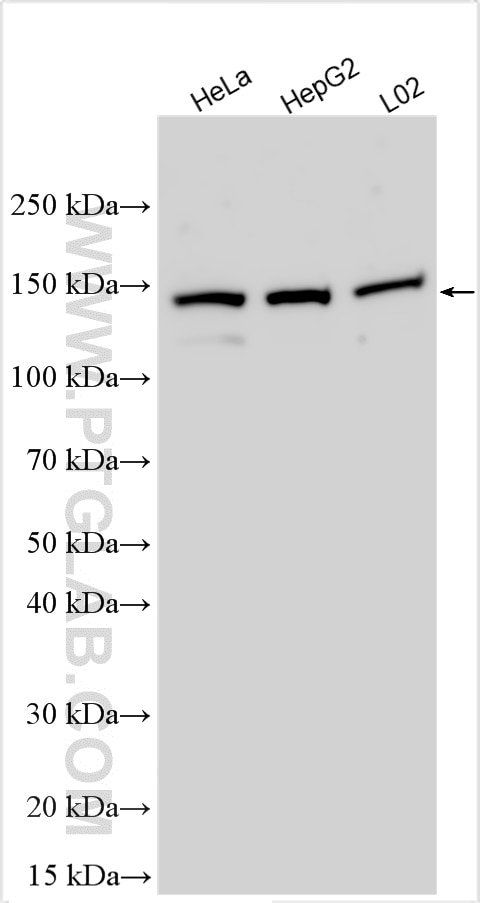 Western Blot (WB) analysis of various lysates using MYPN-Specific Polyclonal antibody (16180-1-AP)