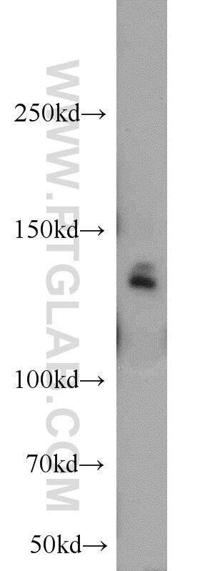 Western Blot (WB) analysis of HeLa cells using MYPN-Specific Polyclonal antibody (16180-1-AP)