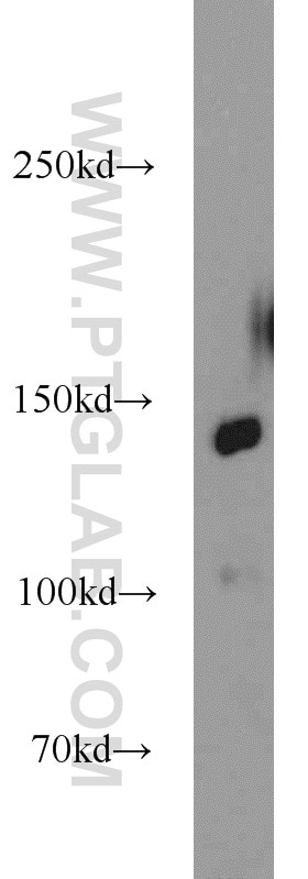 Western Blot (WB) analysis of HeLa cells using MYPN-Specific Polyclonal antibody (16180-1-AP)