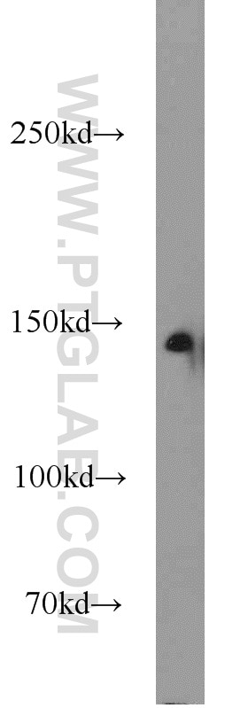 Western Blot (WB) analysis of HeLa cells using MYPN-Specific Polyclonal antibody (16180-1-AP)