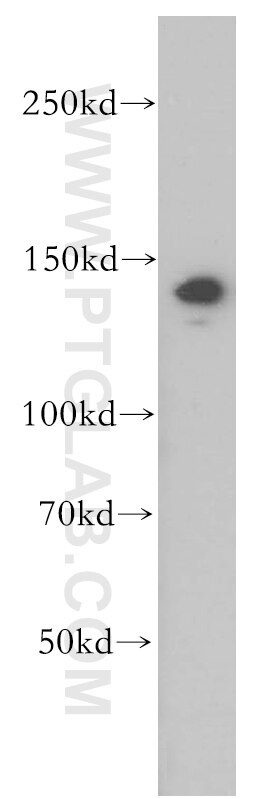 Western Blot (WB) analysis of HeLa cells using MYPN-Specific Polyclonal antibody (16180-1-AP)