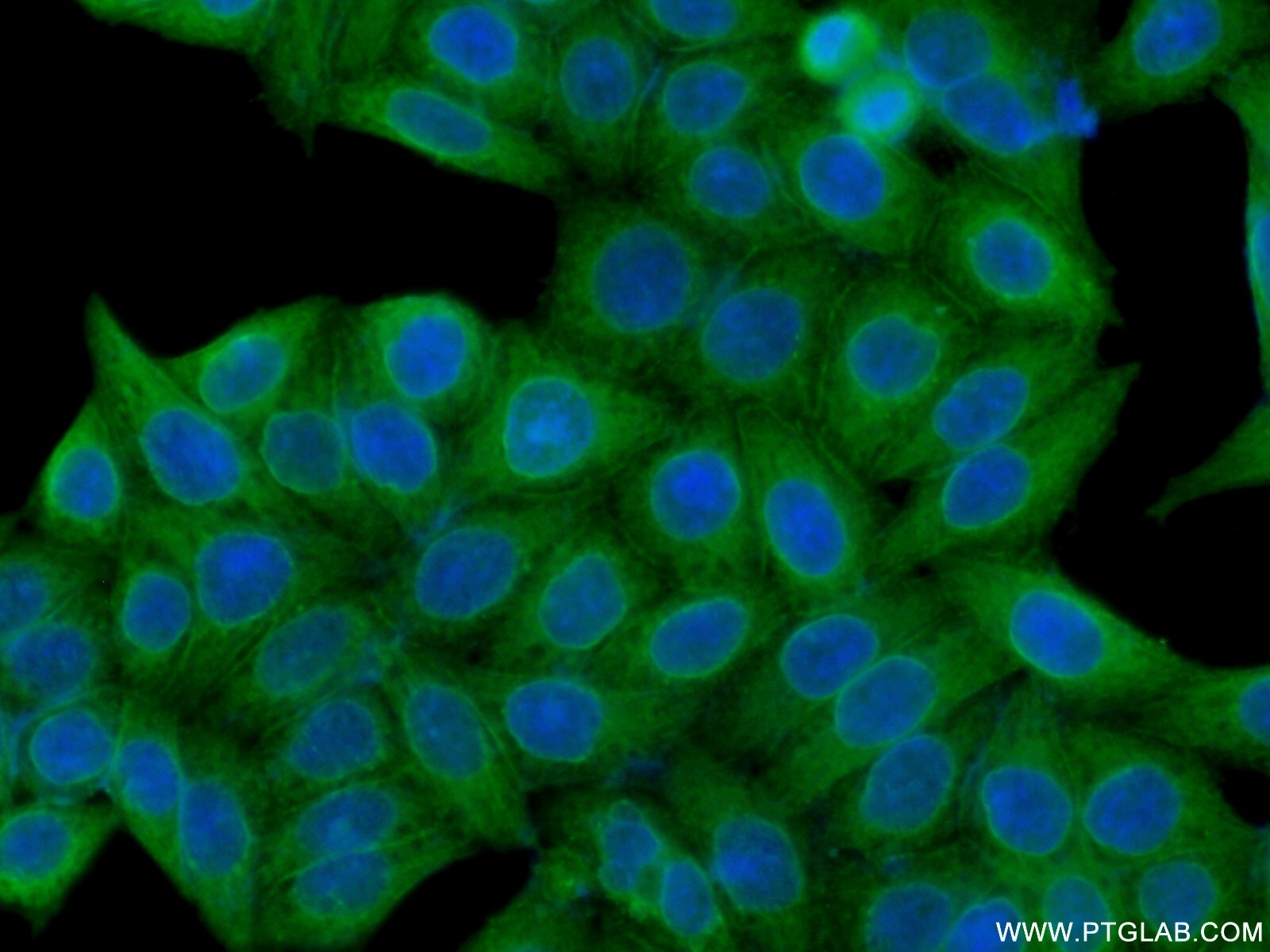 Immunofluorescence (IF) / fluorescent staining of HeLa cells using MYPT1 Polyclonal antibody (22117-1-AP)