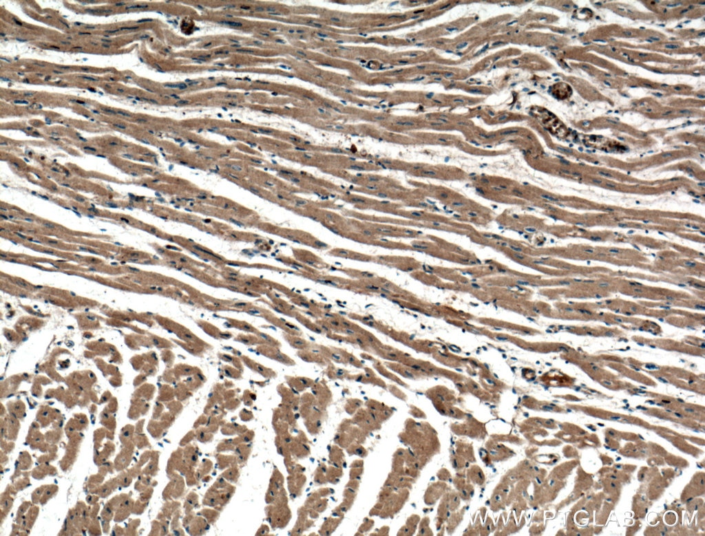 Immunohistochemistry (IHC) staining of human heart tissue using MYPT1 Polyclonal antibody (22117-1-AP)