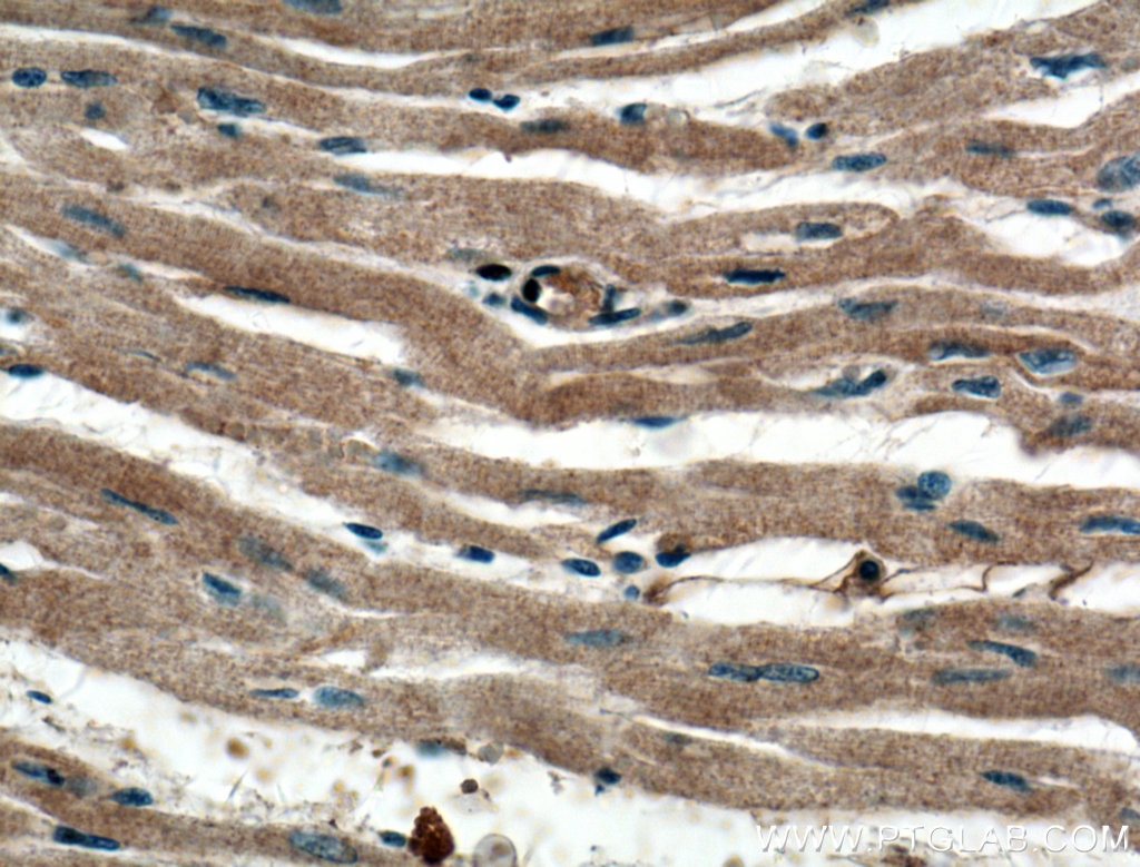Immunohistochemistry (IHC) staining of human heart tissue using MYPT1 Polyclonal antibody (22117-1-AP)