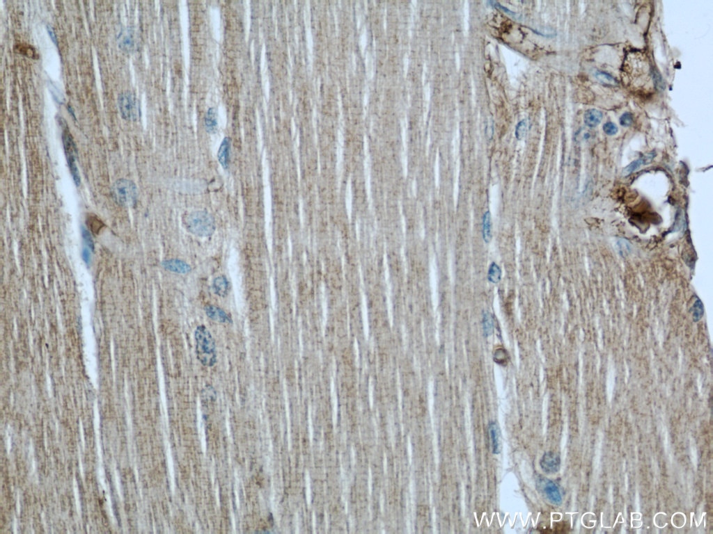 Immunohistochemistry (IHC) staining of human skeletal muscle tissue using MYPT1 Polyclonal antibody (22117-1-AP)