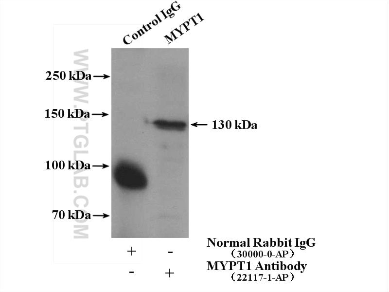 Immunoprecipitation (IP) experiment of HEK-293 cells using MYPT1 Polyclonal antibody (22117-1-AP)