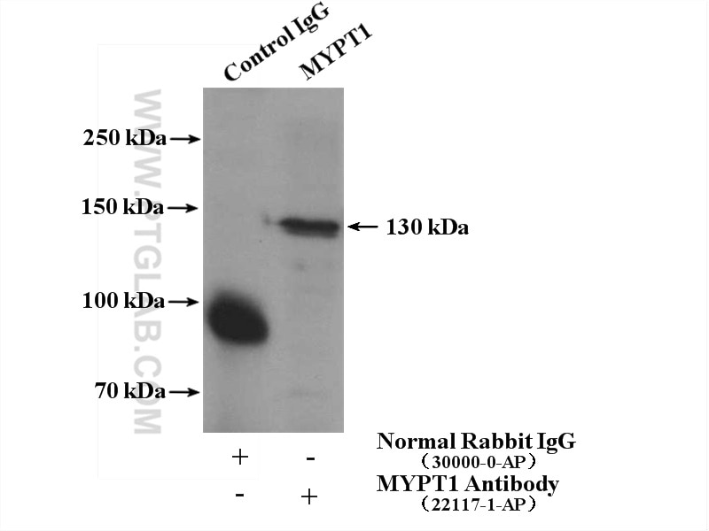 IP experiment of HEK-293 using 22117-1-AP