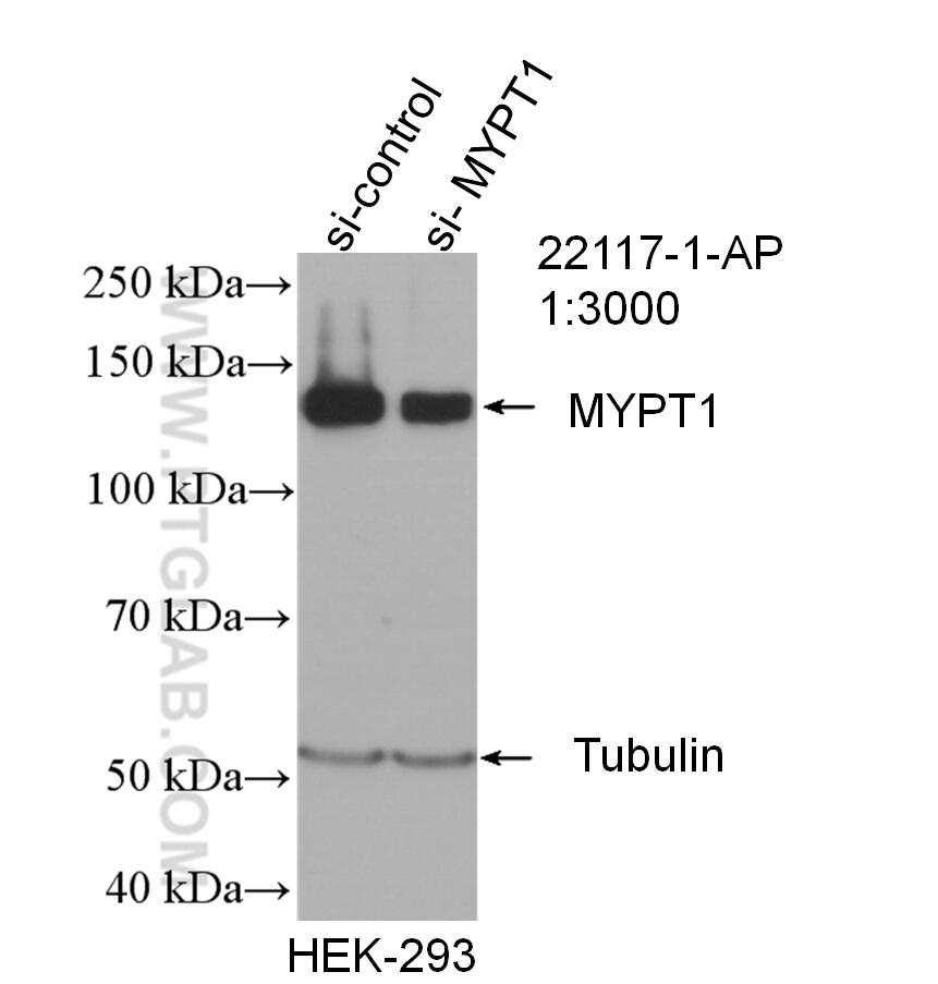 Western Blot (WB) analysis of HEK-293 cells using MYPT1 Polyclonal antibody (22117-1-AP)