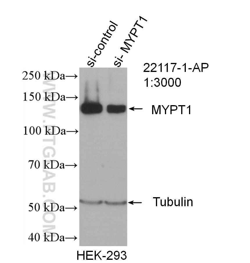 WB analysis of HEK-293 using 22117-1-AP