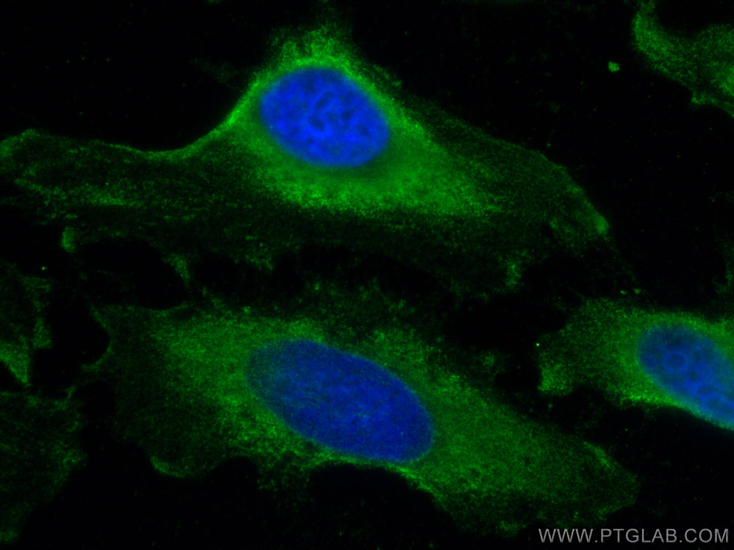 Immunofluorescence (IF) / fluorescent staining of HeLa cells using MYPT1 Monoclonal antibody (66506-1-Ig)