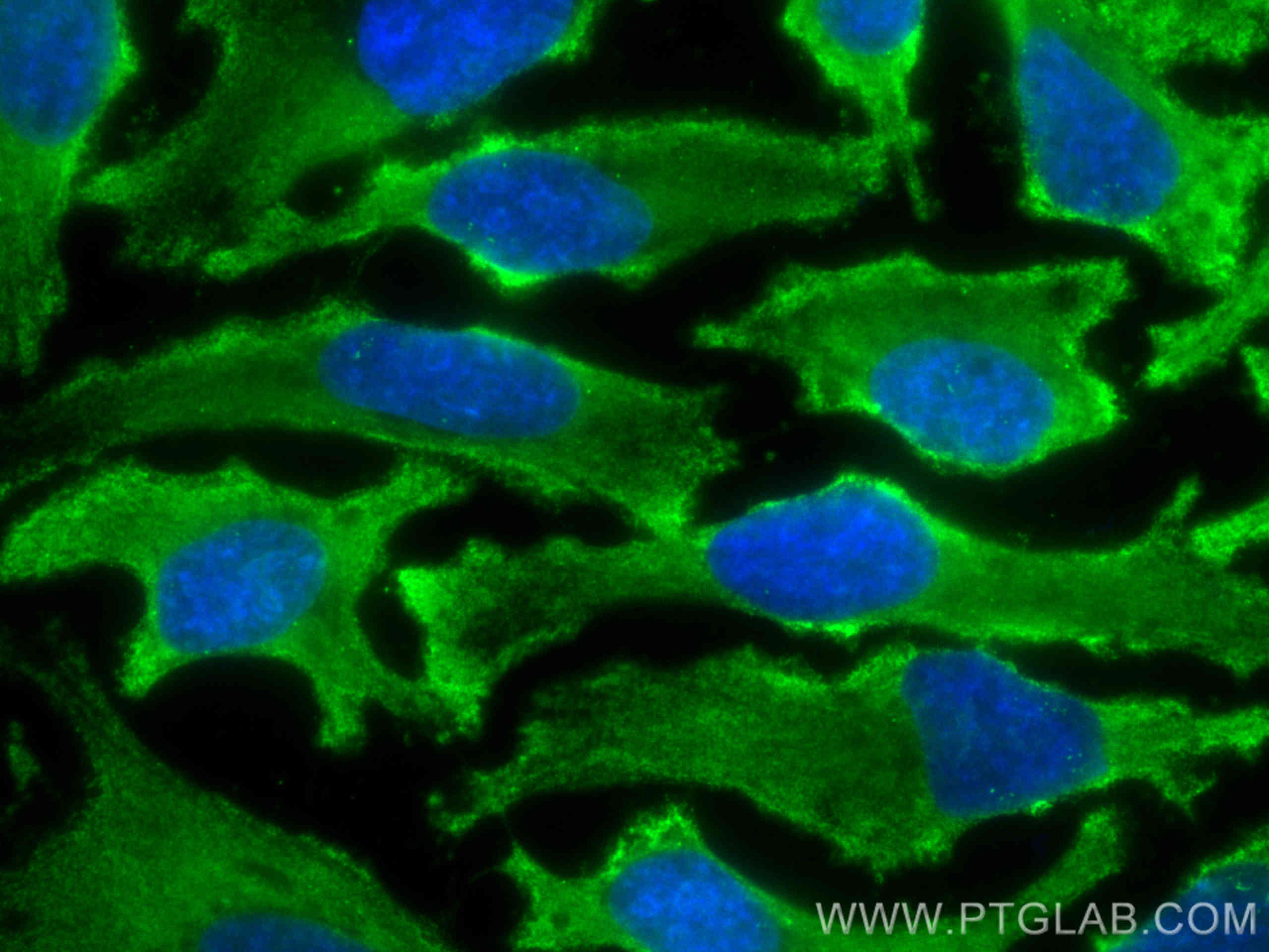 Immunofluorescence (IF) / fluorescent staining of HeLa cells using CoraLite® Plus 488-conjugated MYPT1 Monoclonal ant (CL488-66506)