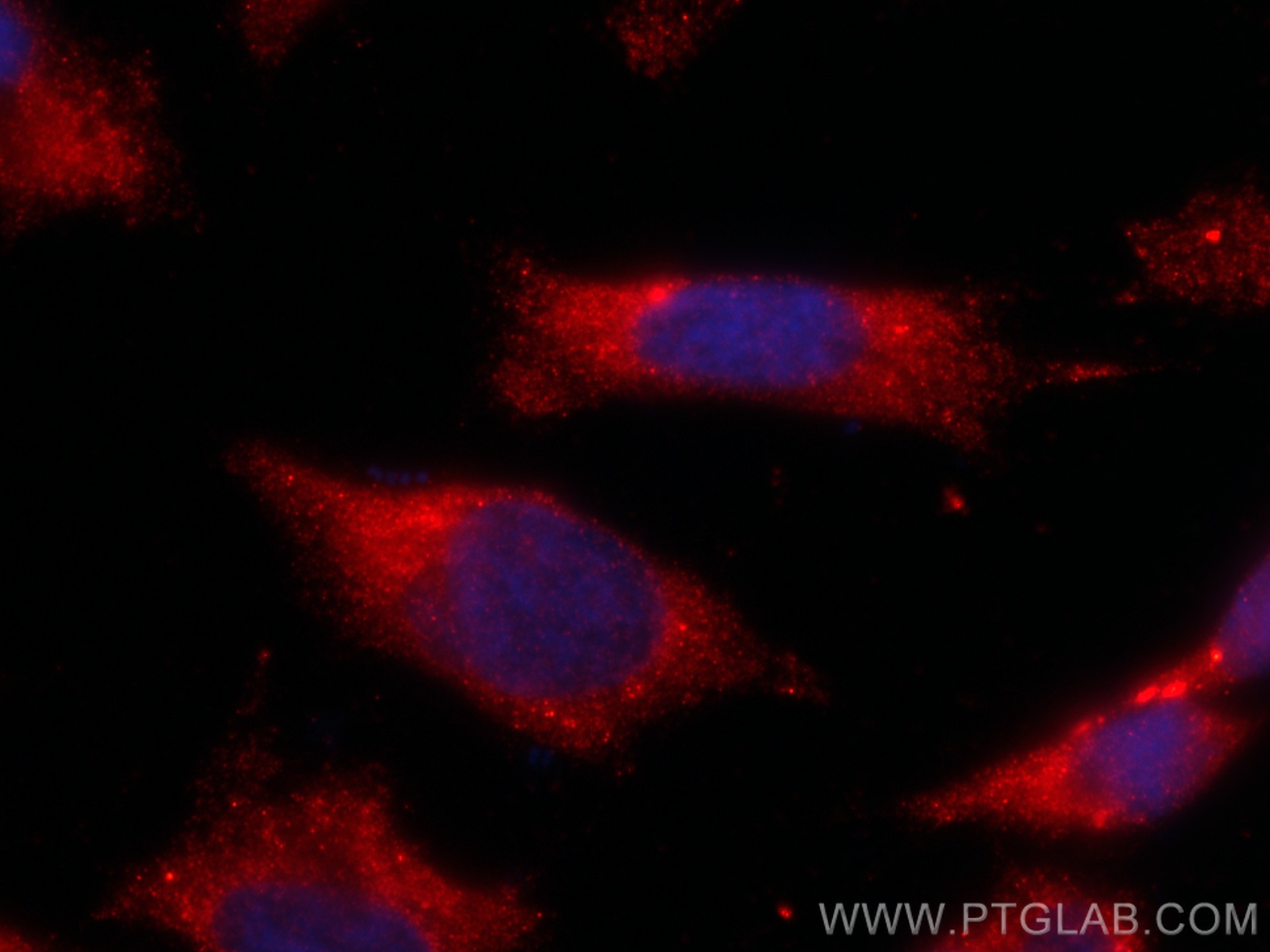 Immunofluorescence (IF) / fluorescent staining of HeLa cells using CoraLite®594-conjugated MYPT1 Monoclonal antibody (CL594-66506)