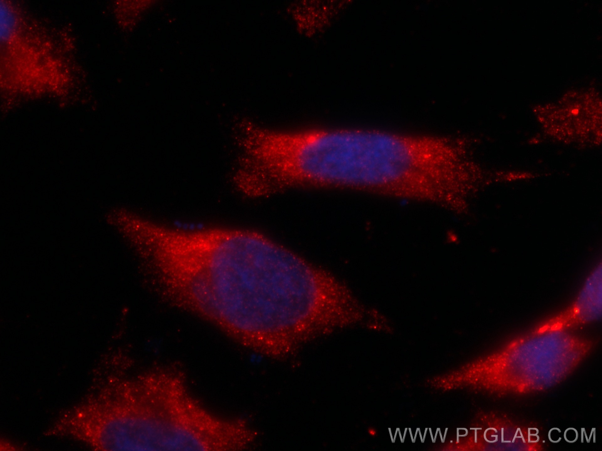 IF Staining of HeLa using CL594-66506