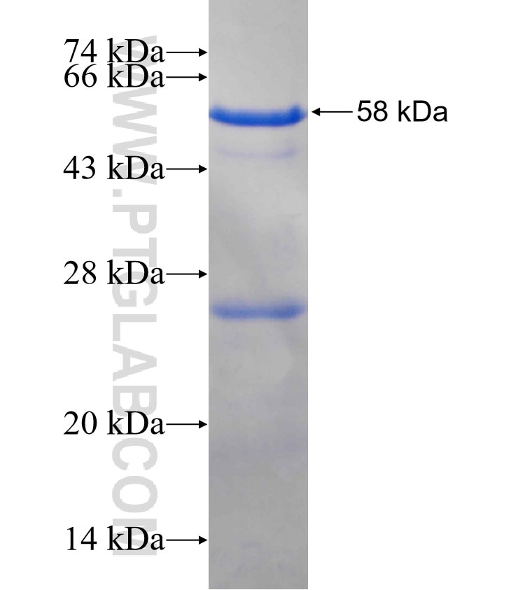 MYRIP fusion protein Ag25558 SDS-PAGE