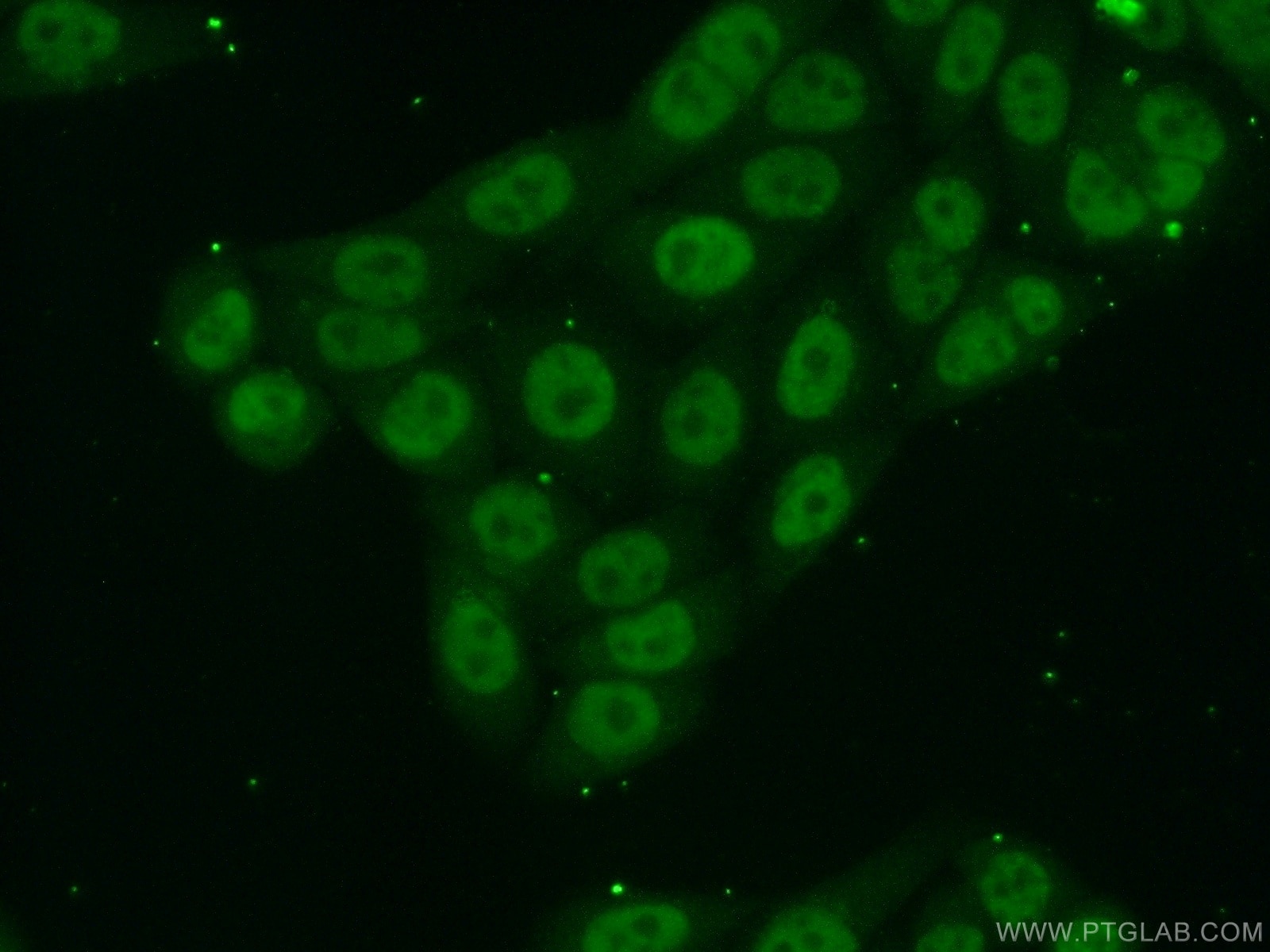 Immunofluorescence (IF) / fluorescent staining of HeLa cells using MYSM1-Specific Polyclonal antibody (20078-1-AP)