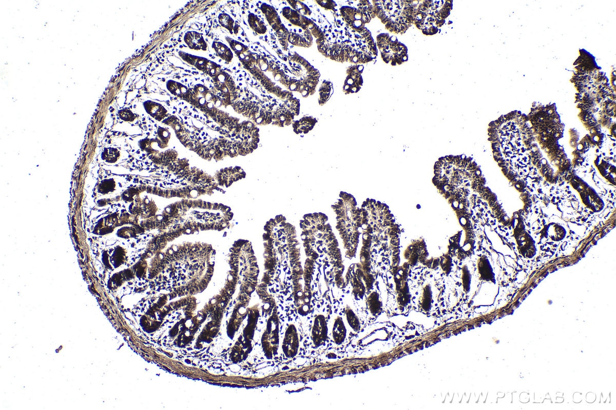 Immunohistochemistry (IHC) staining of mouse small intestine tissue using MYSM1-Specific Polyclonal antibody (20078-1-AP)
