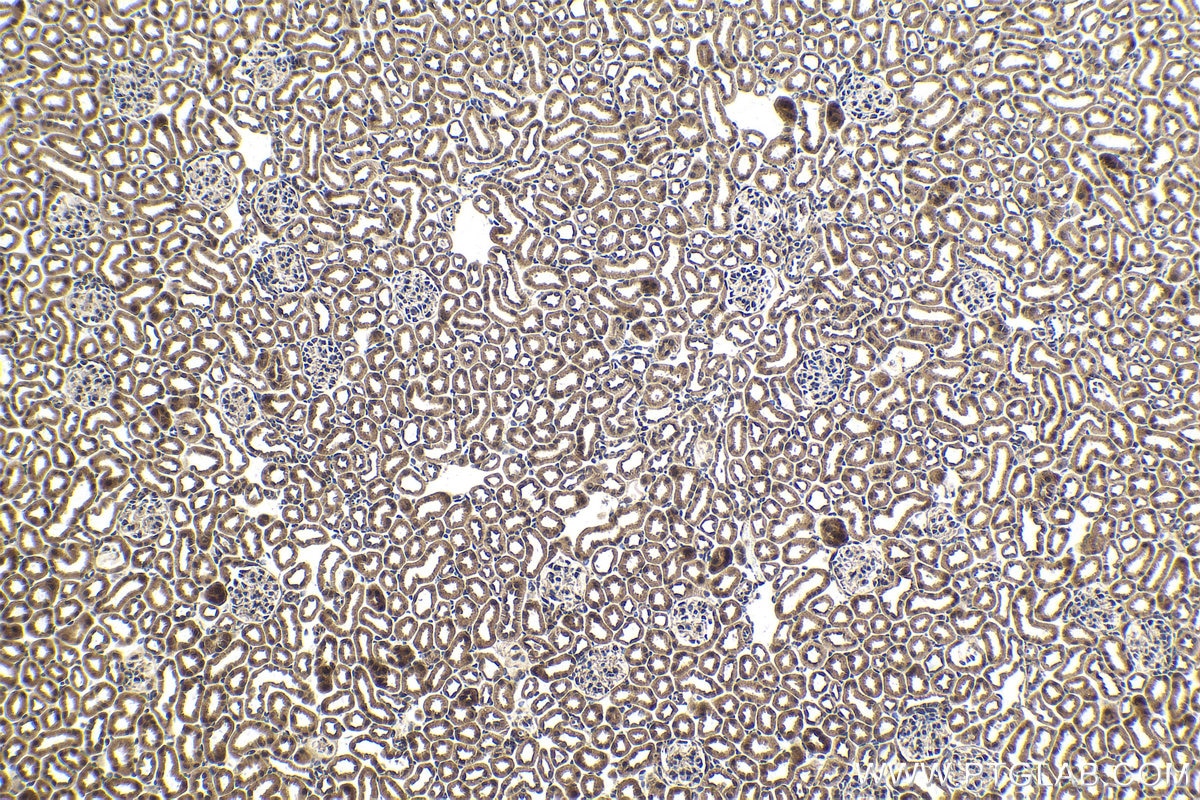 Immunohistochemistry (IHC) staining of mouse kidney tissue using MYSM1-Specific Polyclonal antibody (20078-1-AP)