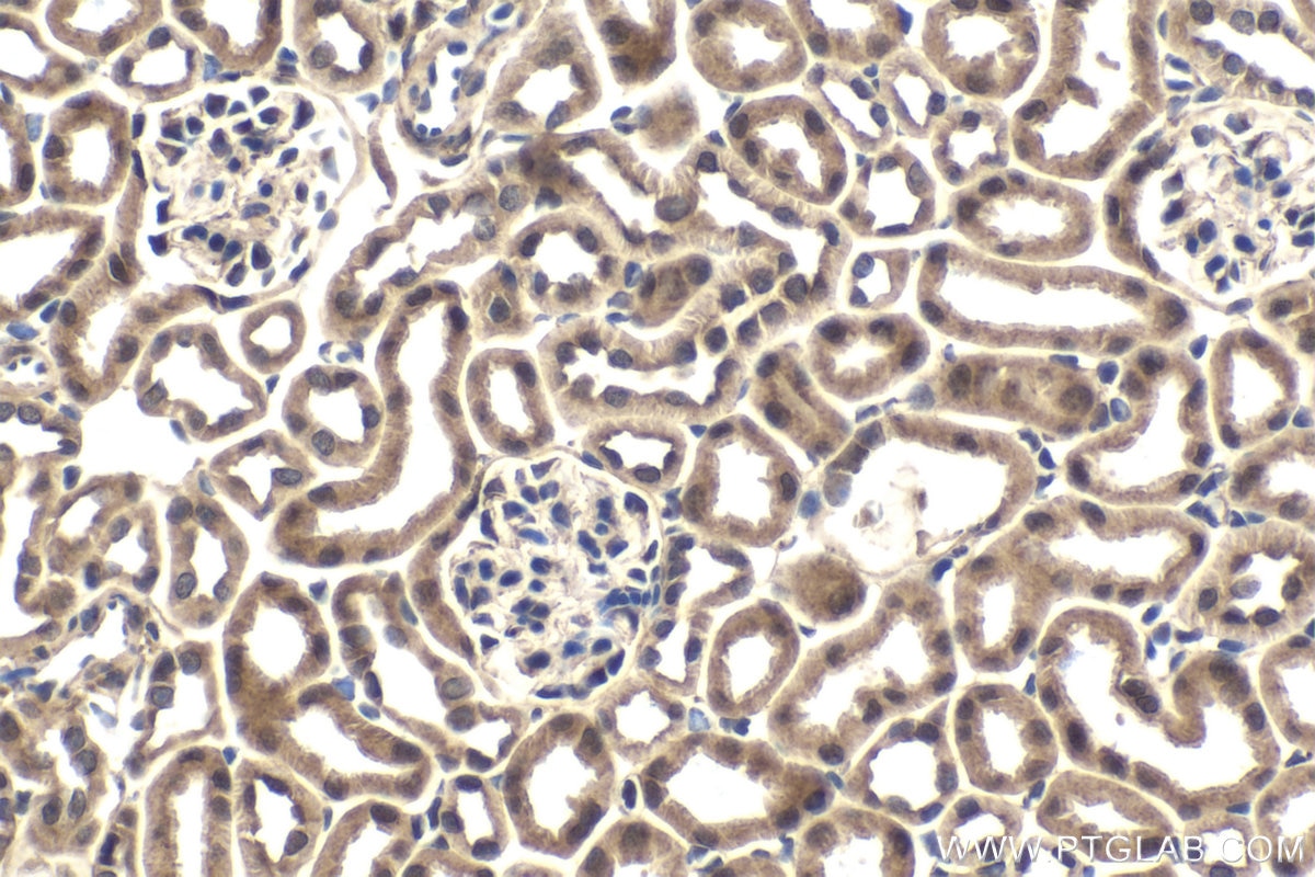 Immunohistochemistry (IHC) staining of mouse kidney tissue using MYSM1-Specific Polyclonal antibody (20078-1-AP)