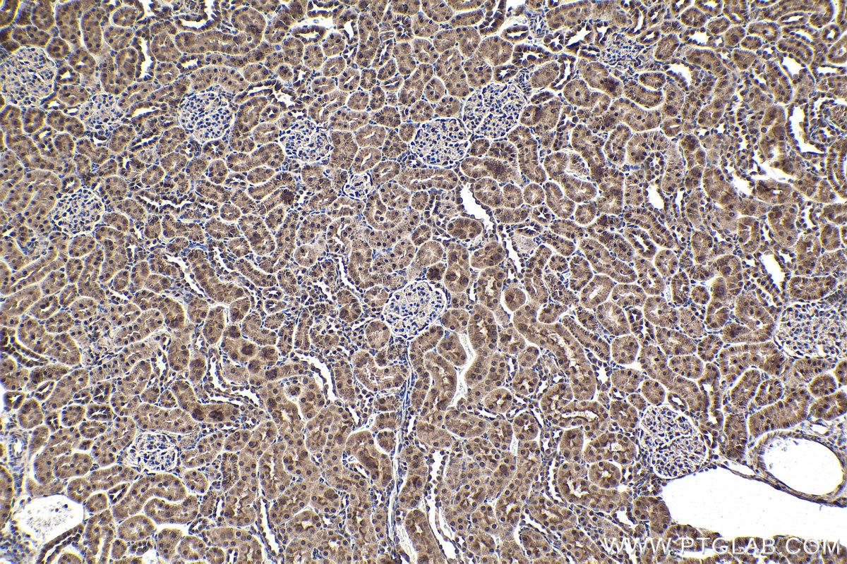 Immunohistochemistry (IHC) staining of rat kidney tissue using MYSM1-Specific Polyclonal antibody (20078-1-AP)
