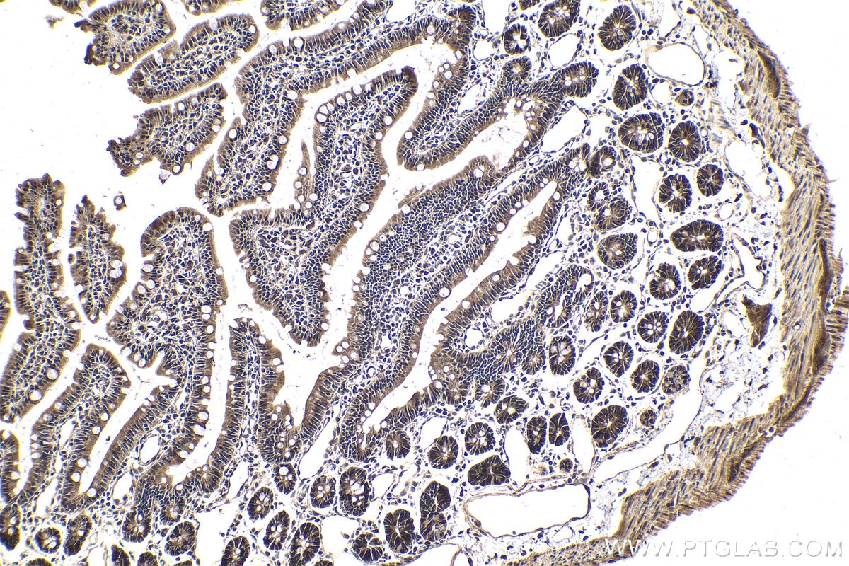 Immunohistochemistry (IHC) staining of rat small intestine tissue using MYSM1-Specific Polyclonal antibody (20078-1-AP)