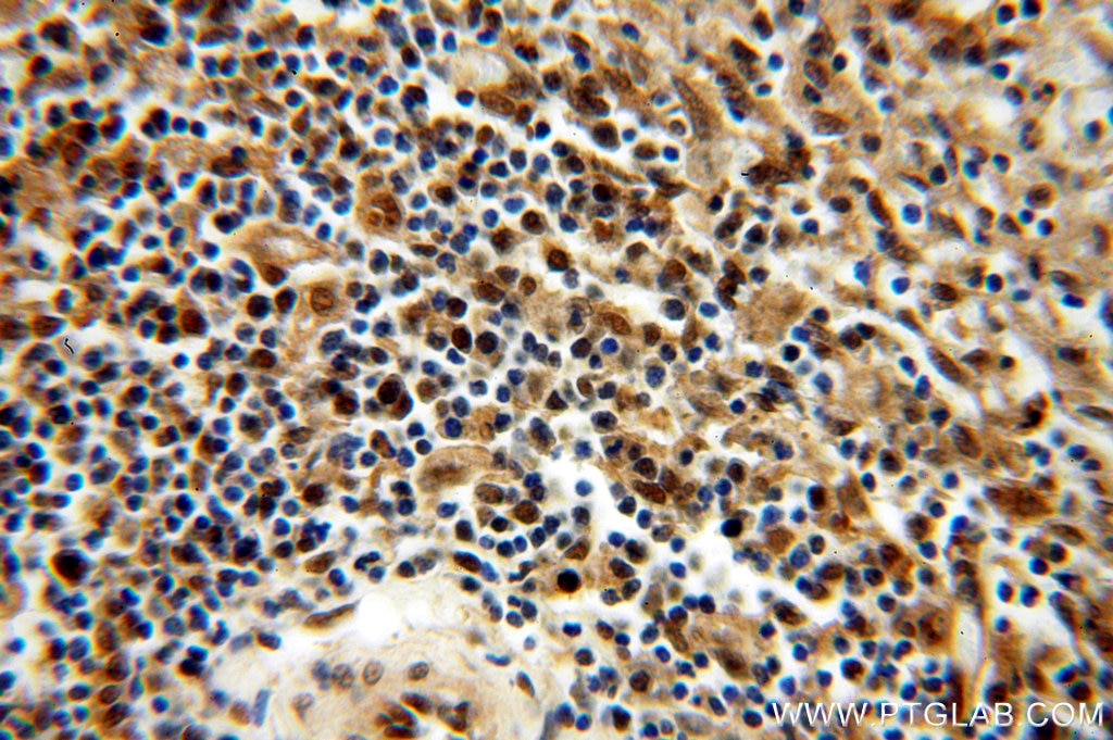 Immunohistochemistry (IHC) staining of human spleen tissue using MYSM1-Specific Polyclonal antibody (20078-1-AP)