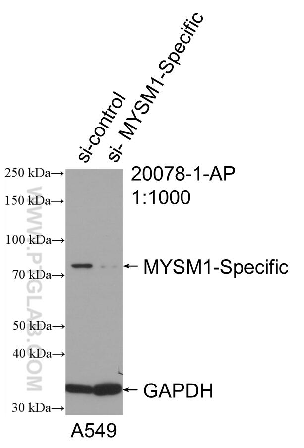 Western Blot (WB) analysis of A549 cells using MYSM1-Specific Polyclonal antibody (20078-1-AP)