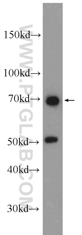 Western Blot (WB) analysis of HEK-293 cells using MYSM1-Specific Polyclonal antibody (20078-1-AP)