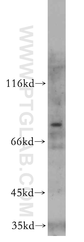 Western Blot (WB) analysis of HepG2 cells using MYSM1-Specific Polyclonal antibody (20078-1-AP)