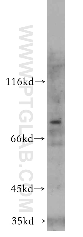 WB analysis of HepG2 using 20078-1-AP