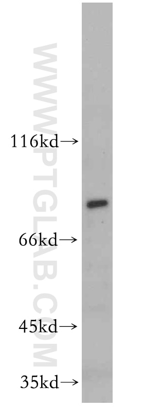 Western Blot (WB) analysis of A549 cells using MYSM1-Specific Polyclonal antibody (20078-1-AP)