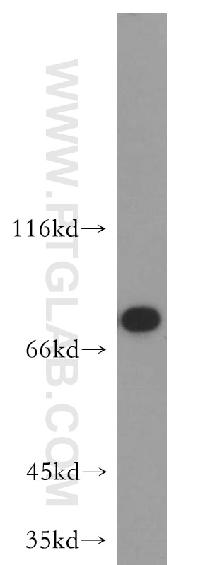 Western Blot (WB) analysis of HeLa cells using MYSM1-Specific Polyclonal antibody (20078-1-AP)